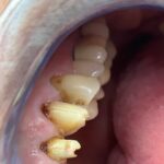 thumbnail_IMG_2719 (1)